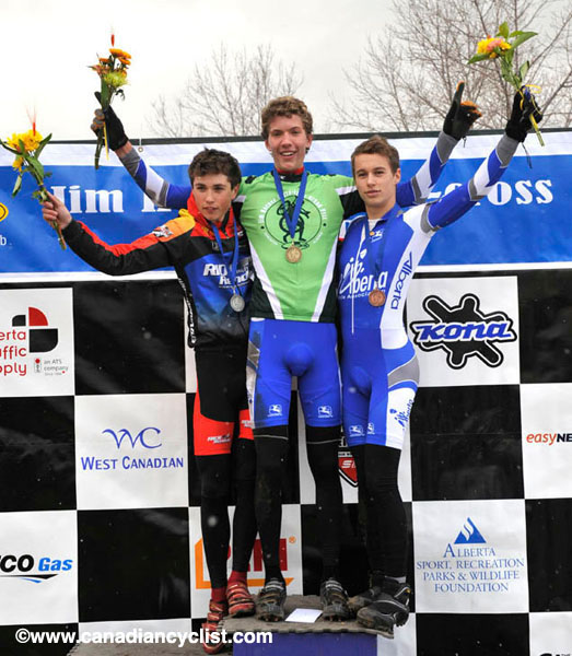 Cyclocross National Champion hips