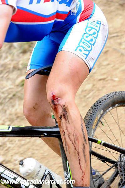 MTB World Championships