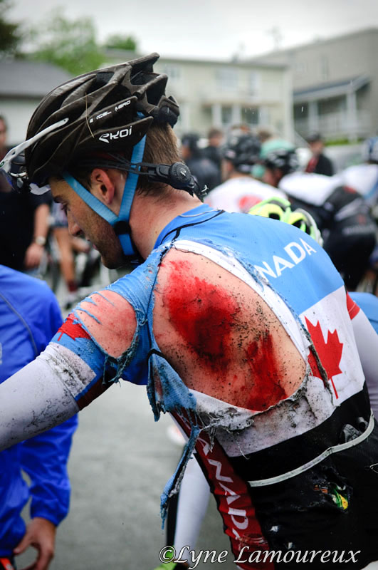 Hugh Houle (Canada National Team) shows th aftermath of the cras