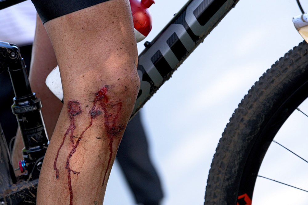 2019 MTB World Cup MSA