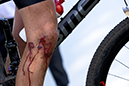 2019 MTB World Cup MSA